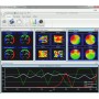 SISTEM B-Alert pentru achizitie Wireless a semnalului EEG